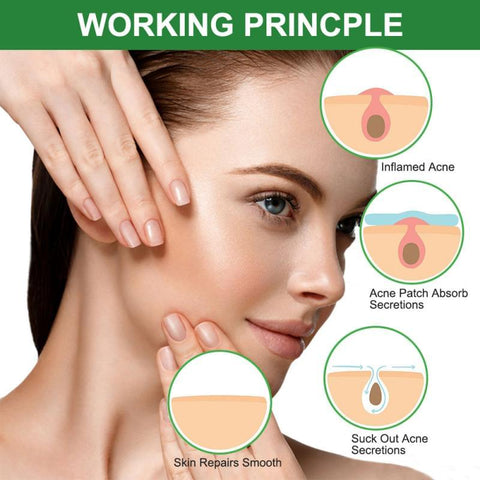 Acne Pimple Patch Skin Care
