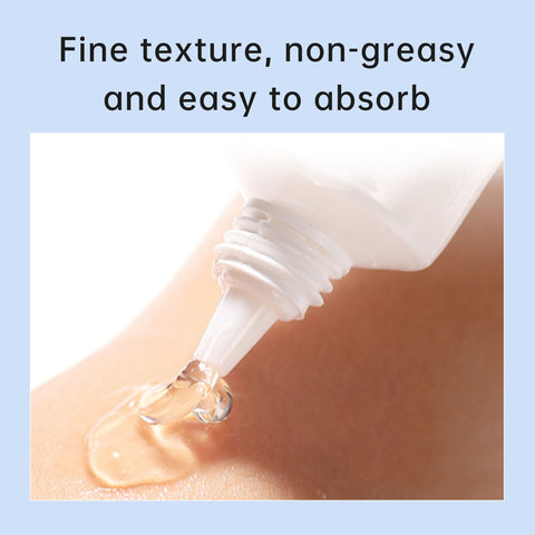 New Herbal Acne Treatment Cream