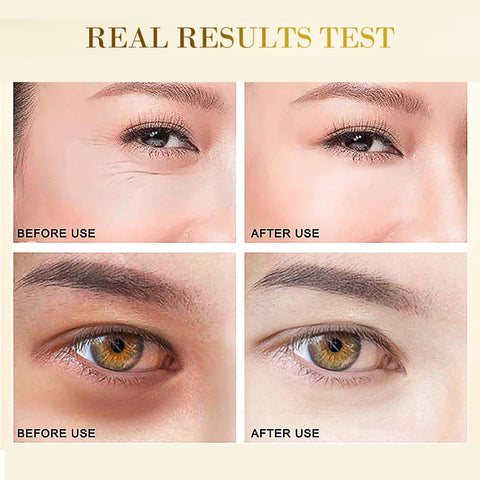 24K Gold Hyaluronic Acid Eye Mask Remove