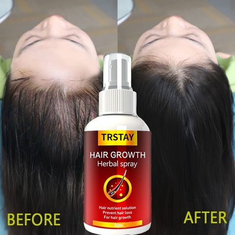 New Fast Hair Growth Liquid
