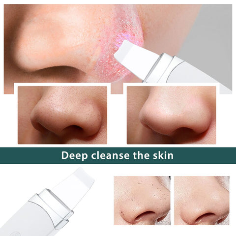 Professional Ultrasonic Facial Skin Scrubber