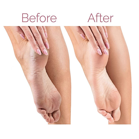 Electric Foot File for Heels Grinding Pedicure Tools