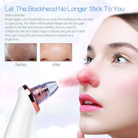 Rechargeable Blackhead Remover Care Tool