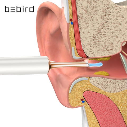 Smart Visual Ear Cleaner