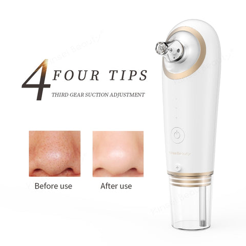 Blackhead Remover Machine