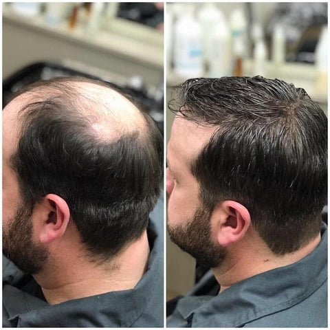 Onion Black Seed Hair