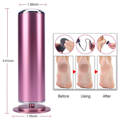 Foot Electric Skin Callus Remover