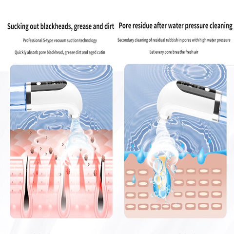 USB Water Cycle Blackhead Remover
