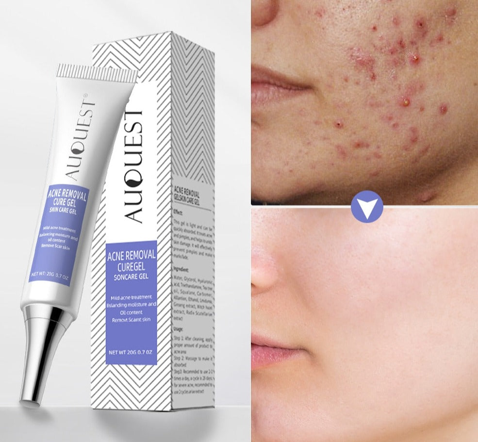 |<none>|3256804596777967