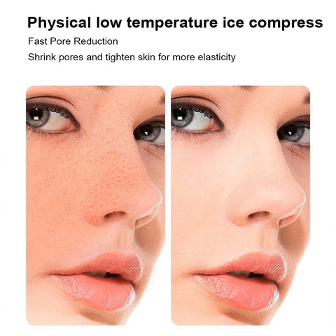 Ice Facial Roller massager