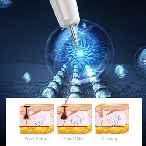 Skin Tag Remover Freckle Plasma Pen