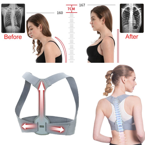 Back Posture Corrector